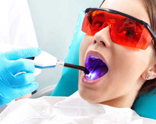Laser Dentistry Treatment in Ahmedabad